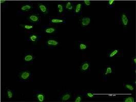 Anti-RAD18 Antibody