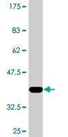 Anti-RAD23B Antibody