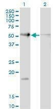 Anti-RAD23B Antibody