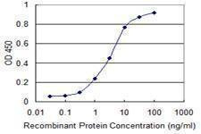 Anti-RAD23B Antibody
