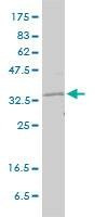 Anti-RAD51 Antibody