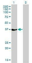 Anti-RAD51 Antibody