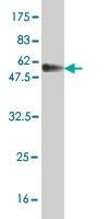 Anti-RAD51 Antibody