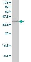 Anti-RAD51C Antibody