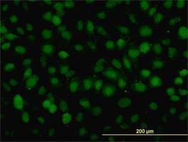 Anti-RAD54B Antibody