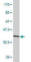 Anti-RAD54L Antibody