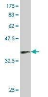 Anti-RAF1 Antibody