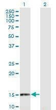 Anti-RANGRF Antibody