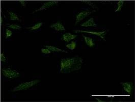 Anti-RANGRF Antibody