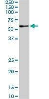 Anti-RARA Antibody