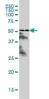 Anti-RARA Antibody