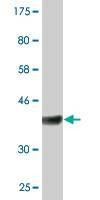 Anti-RASA1 Antibody