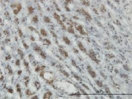 Anti-RASEF Antibody