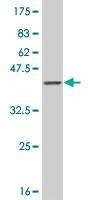 Anti-RASEF Antibody