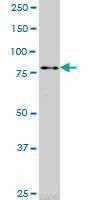 Anti-RASEF Antibody