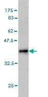 Anti-RASGEF1C Antibody
