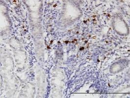 Anti-RASGEF1C Antibody