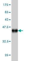 Anti-RASGRP4 Antibody