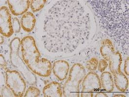 Anti-RASGRP4 Antibody
