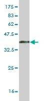 Anti-RBMS2 Antibody