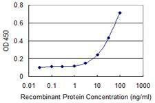 Anti-RBMY1A1 Antibody