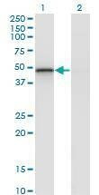 Anti-RCN2 Antibody