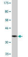Anti-RCV1 Antibody