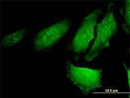 Anti-RERG Antibody