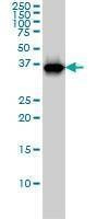 Anti-RFC4 Antibody