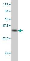 Anti-RFC4 Antibody