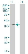 Anti-RFC4 Antibody
