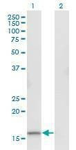 Anti-RGS13 Antibody