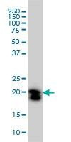 Anti-RHOA Antibody