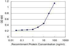 Anti-RHOA Antibody
