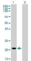 Anti-RHOA Antibody