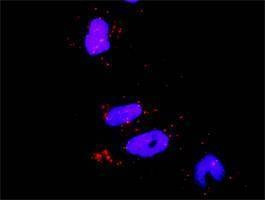 Anti-RHOA Antibody