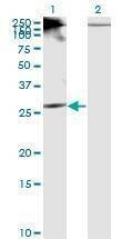 Anti-RICTOR Antibody
