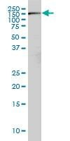 Anti-RICTOR Antibody