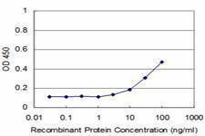 Anti-RIPK4 Antibody