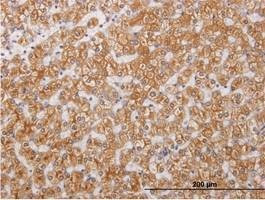 Anti-RIPK4 Antibody