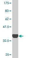 Anti-RNF13 Antibody