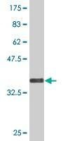 Anti-RNF148 Antibody
