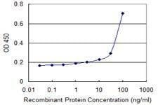 Anti-RNF148 Antibody