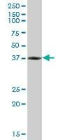 Anti-RNF2 Antibody