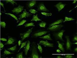 Anti-RNF2 Antibody
