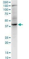 Anti-RNF2 Antibody