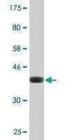 Anti-RNF25 Antibody
