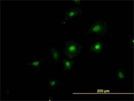 Anti-RNPC2 Antibody