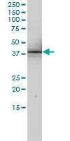Anti-RNUT1 Antibody