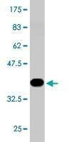 Anti-ROBO2 Antibody